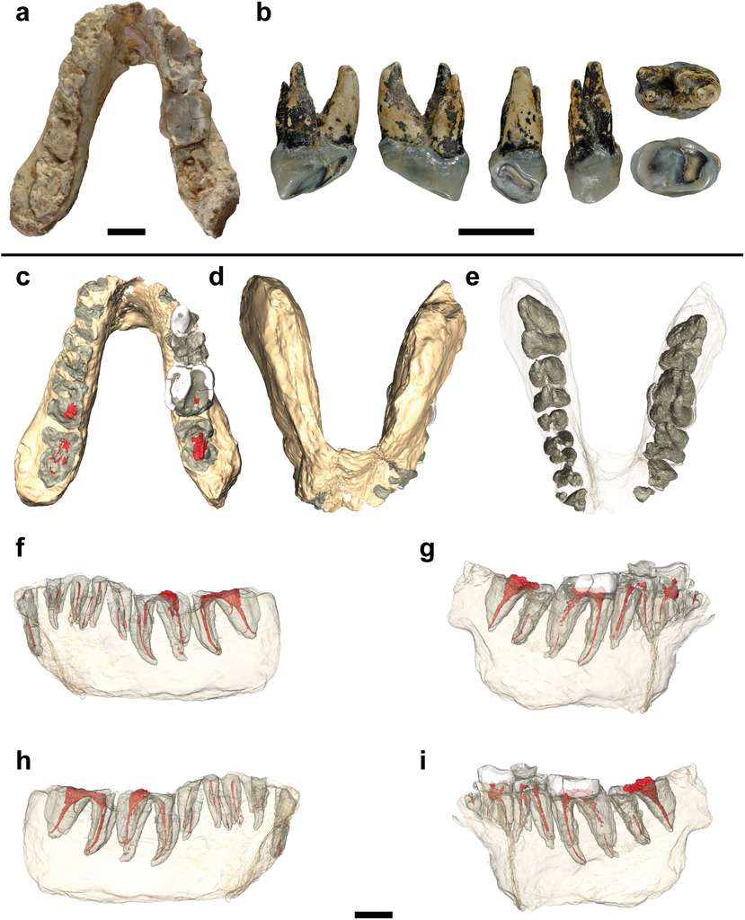 En haut, la mandibule de Graecopithecus freybergi trouvée à Pyrgos, en Grèce et, à gauche, la dent découverte à Azmaka, en Bulgarie, et appartenant à un animal appartenant au même genre, Graecopithecus sp., si ce n'est à la même espèce. De c à e, différentes vues de la mandibule et, de f à i, les images construites au scanner CT, montrant l'implantation des dents. Les barres d'échelle représentent toutes 1 cm. © Jochen Fuss et al., Plos One En haut, la mandibule de Graecopithecus freybergi trouvée à Pyrgos, en Grèce et, à gauche, la dent découverte à Azmaka, en Bulgarie, et appartenant à un animal appartenant au même genre, Graecopithecus sp., si ce n'est à la même espèce. De c à e, différentes vues de la mandibule et, de f à i, les images construites au scanner CT, montrant l'implantation des dents. Les barres d'échelle représentent toutes 1 cm. © Jochen Fuss et al., Plos One