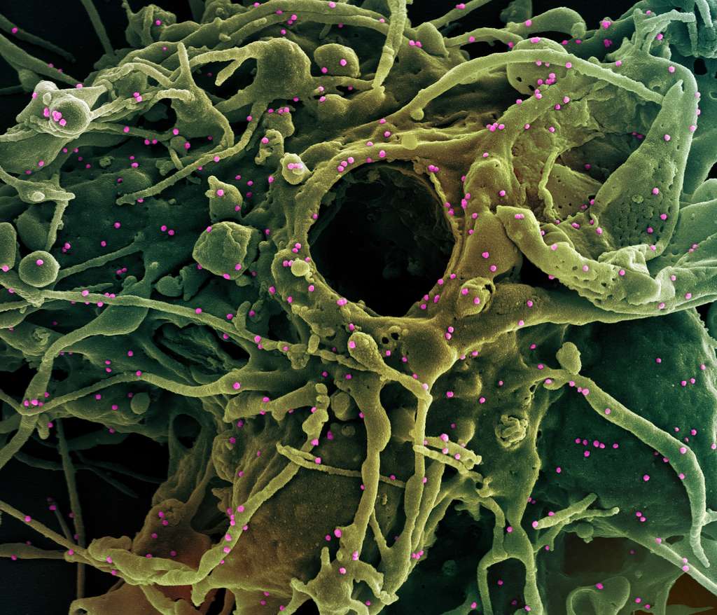 Une image du variant britannique B.1.1.7 (en rose) infectant une cellule humaine (en vert). © Niaid