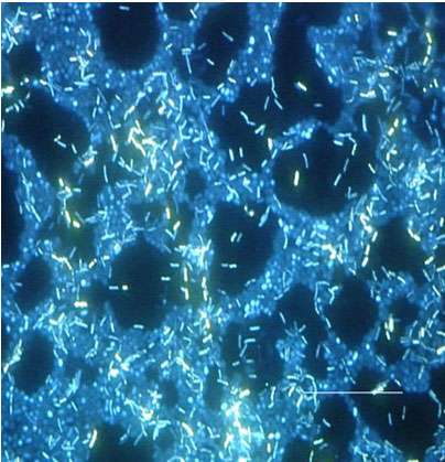 Photo en épifluorescence d'un biofilm (ensemble de bactéries). © Ricardo Murga and Rodney Donlan, Domaine public