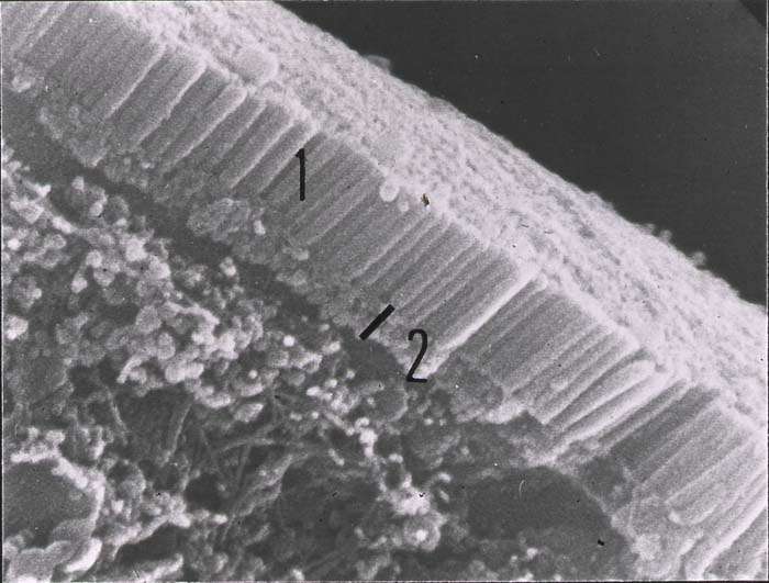 Les entérocytes, des cellules de l'intestin avec des microvillosités Les entérocytes, des cellules de l'intestin avec des microvillosités
