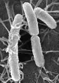 La bactérie E.coli Crédits : http://archquo.nouvelobs.com