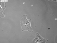 Sous le microscope à contraste de phase, cette cellule d'épithélium rénal s'apprête à se diviser nullement dérangée par la caméra qui pourra filmer les trois générations suivantes. Crédit : Ted Hinchcliffe (University of Notre Dame), Kip Sluder (Univiversity of Massachusetts Medical School) Sous le microscope à contraste de phase, cette cellule d'épithélium rénal s'apprête à se diviser nullement dérangée par la caméra qui pourra filmer les trois générations suivantes. Crédit : Ted Hinchcliffe (University of Notre Dame), Kip Sluder (Univiversity of Massachusetts Medical School)