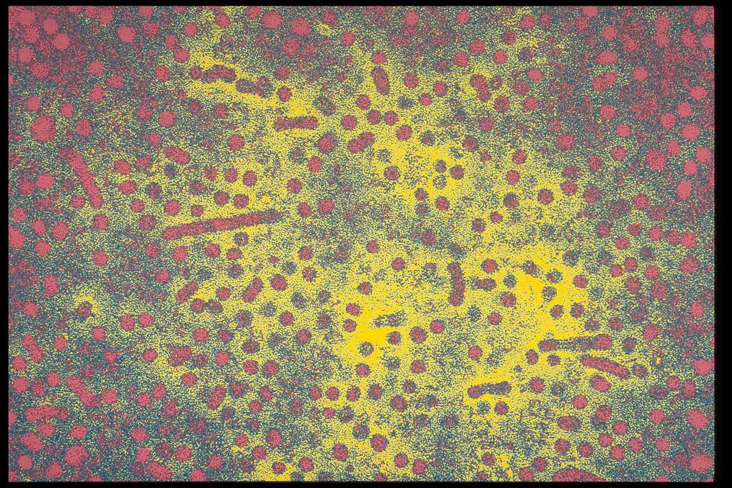 Des virus de l'hépatite B. © Sanofi Pasteur