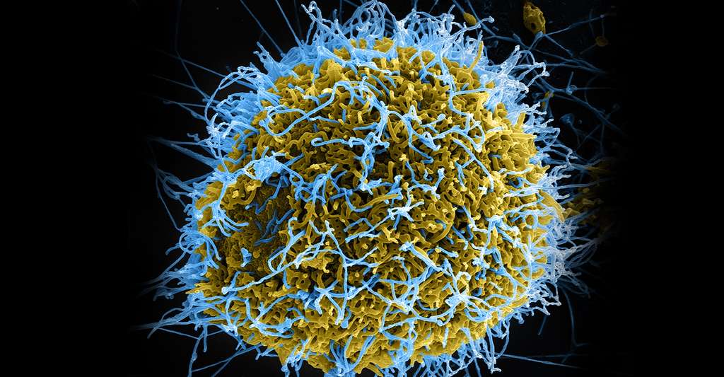 Où en est la recherche sur les vaccins ? Ici, le virus Ébola. © NIAID, CC by 2.0