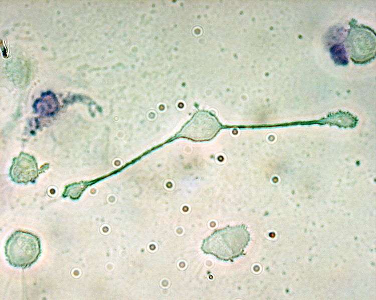 Les macrophages sont des cellules du système immunitaire impliquées dans plusieurs fonctions de défense de l'organisme, aussi bien chez les salamandres que chez les êtres humains. Mais chez ces amphibiens, elles contrôlent aussi le processus de régénération. © Obli, Wikipédia, cc by sa 2.0