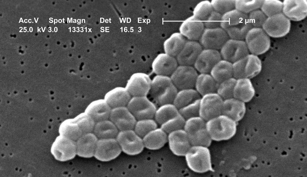 Les Acinetobacter – vues ici au microscope électronique – constituent un genre de bactérie que les ingénieurs ont bien du mal à éliminer des engins spatiaux. Et pour cause, elles semblent se nourrir des produits de nettoyage qu’ils emploient. © CDC’s Public Health Image Library, Wikipedia, Domaine public