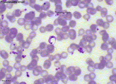 Le trypanosome, un parasite d'une famille dangereuse. © Pan American Health Organization