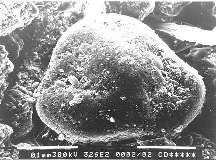 Grain de sable usé recouvert de quelques diatomées. © Reproduction et utilisation interdites