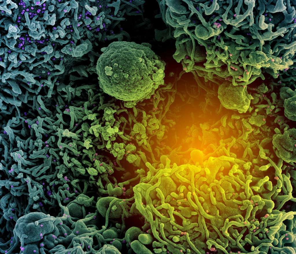 Micrographie électronique à balayage colorisée d’une cellule (bleu et vert) infectée par le variant Alpha du SARS-CoV-2 (B.1.1.7- violet et rose), isolée d’un échantillon de patient. NIAID / NIH