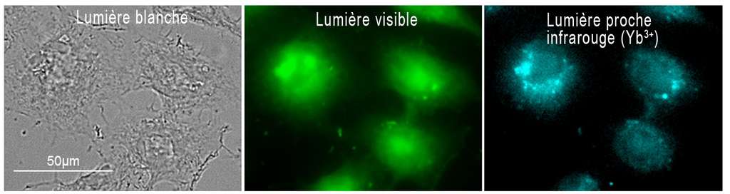 Cellules « HeLa » (issues d’une lignée cancéreuse) ayant été incubées avec le nano-MOF-Yb-PVDC-3, un nouveau marqueur. L'imagerie proche infrarouge permet de localiser de façon plus précise le signal de fluorescence émis par ce nano-MOF (metal-organic framework) sans lumière parasite d'autofluorescence dans le visible. © CBM