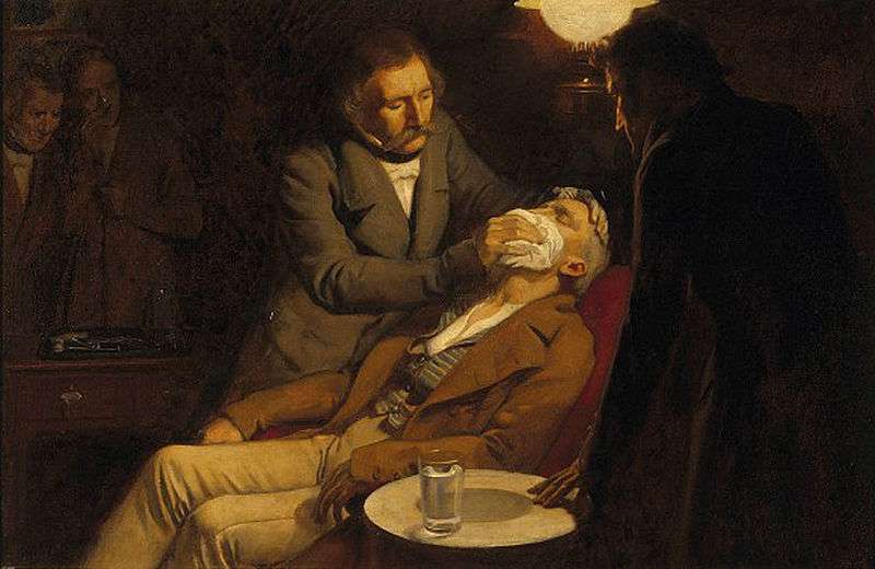 1846 : William Morton et les débuts de l'anesthésie 1846 : William Morton et les débuts de l'anesthésie
