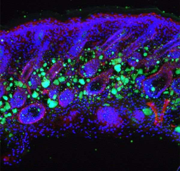 Sur cette image, des cellules de peau en bleu et des cellules adipeuses en vert. Celles-ci — en plus de donner à la peau un aspect jeune — constituent une barrière qui empêche les bactéries de pénétrer dans le corps. © Université de Californie à San Diego