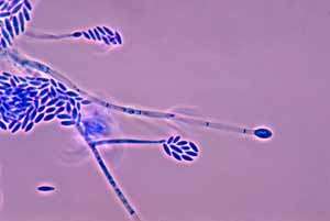 Fusarium solani. La forme en fuseau de ses spores lui donne son nom. Crédit : Public Health Image Library, Dr. Libero Ajello