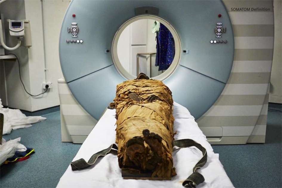 Le corps momifié de Nesyamun, prêt à passer au scanner de l’université de Leeds. Le prêtre égyptien officiait sous le règne de Ramsès XI, il y a quelque 3.000 ans. © Leeds Teaching Hospitals, Leeds Museums and Galleries