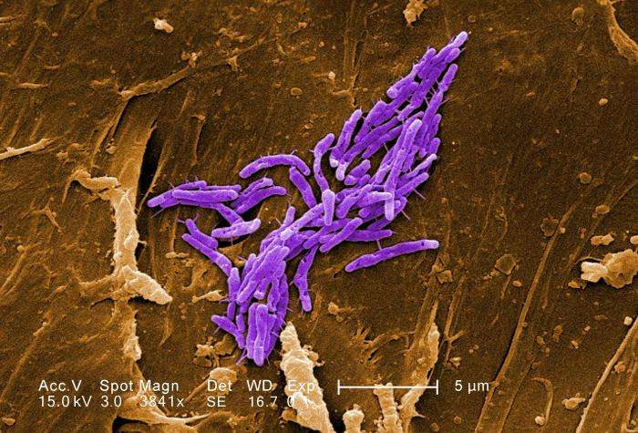 Les mycobactéries non tuberculeuses, comme Mycobacterium fortuitum vue au microscope électronique à balayage, s'attaquent à différents organes du corps. Celle-ci par exemple crée des lésions cutanées. Elle s'attrape principalement après consommation d'eau infectée. Souvent bénigne, elle peut prendre d'autres proportions chez des personnes immunodéficientes. © Margaret Williams, Janice Haney Carr, CDC, DP