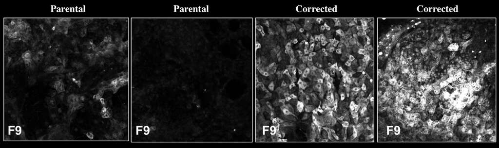 À gauche : les cellules des patients ont des niveaux bas de facteur IX. À droite : après correction du gène, les cellules produisent des niveaux normaux de FIX. © Salk Institute