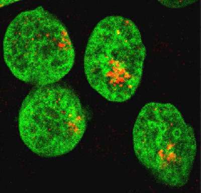 Cassures double brin (en orange) par irradiation alpha de l’ADN (en vert) de kératinocytes © CNRS-CENBG