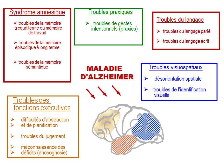 Exposé Sur La Maladie D’Alzheimer – ELZYL