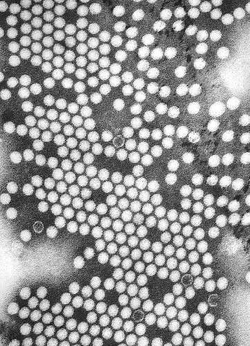Des poliovirus observés au microscope électronique. © CDC