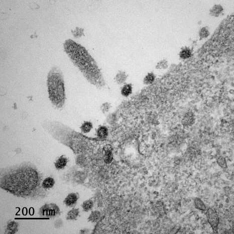 Microscopie électronique d’une cellule infectée par le SARS-CoV-2. © Philippe Roingeard et Sébastien Eymieux, unité Inserm U1259, Morphogenèse et antigénicité du VIH et des virus des hépatites, Université de Tours, France