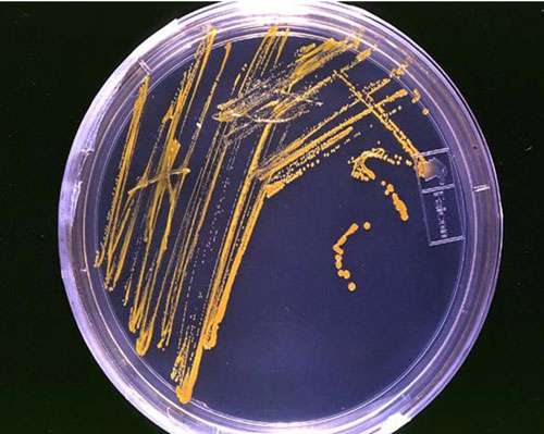 Colonies de bactéries sur un milieu gélosé : une colonie isolée représente un clone. © Domaine public