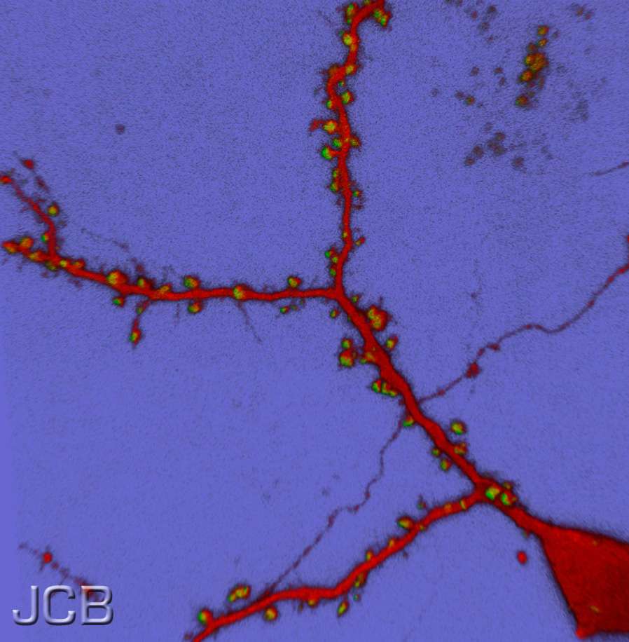 Les épines apparaissent en vert le long des bras dendritiques, en rouge, du neurone. Six heures après l’apprentissage, le nombre d’épines dendritiques est bien supérieur à celui du cerveau d’une souris qui n’a rien appris. © Kenneth Young, Journal of Cell Biology