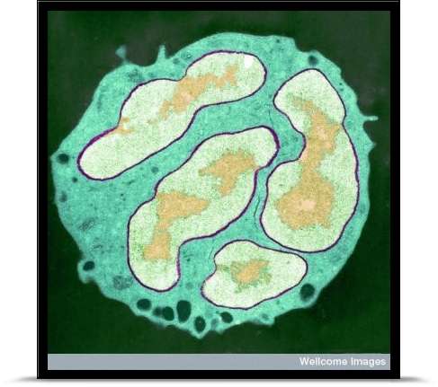 Les neutrophiles polynucléaires, capables de phagocytose, semblent présenter plusieurs noyaux, comme le démontre cette image qui correspond à une coupe. En réalité, ils n’en possèdent qu’un seul, composé de différents lobes. © University of Edinburgh, Wellcome Images, Flickr, cc by nc nd 2.0