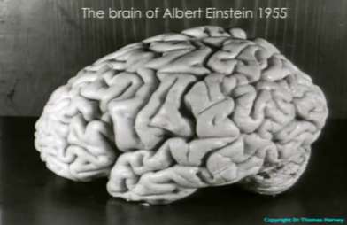 Une photographie du cerveau d'Albert Einstein prise par Harvey juste après l'autopsie. © Thomas Harvey