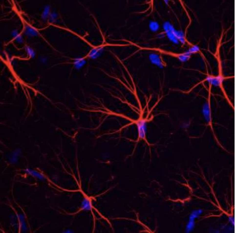 Astrocytes dans l'hippocampe du cerveau de la souris. © Laboratoire des maladies neurodégénératives (CNRS/CEA/Université Paris Saclay)
