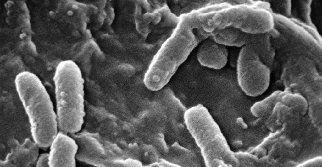 En plus de perturber la formation des biofilms, le cinnamaldéhyde réduit la mobilité de Pseudomonas aeruginosa, vue ici au microscope électronique à balayage. © Janice Haney Carr, Wikipedia, Domaine public