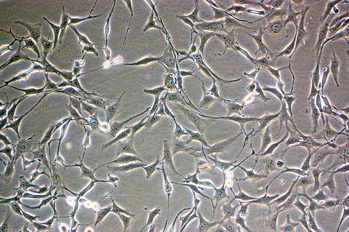 Des fibroblastes peuvent être reprogrammés en cellules sanguines grâce à l'expression du gène oct4 et à la mise en culture des cellules dans un milieu contenant des cytokines particulières. © Raffyd, Flickr, CC by-nc 2.0