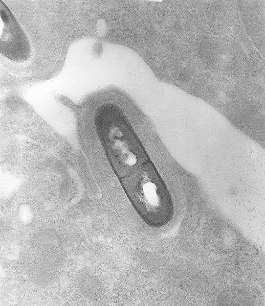 Les souris aseptisées infectées par Listeria monocytogenes n’ont pas survécu, contrairement à leurs congénères disposant d’une flore intestinale. © CDC, Wikipédia, DP