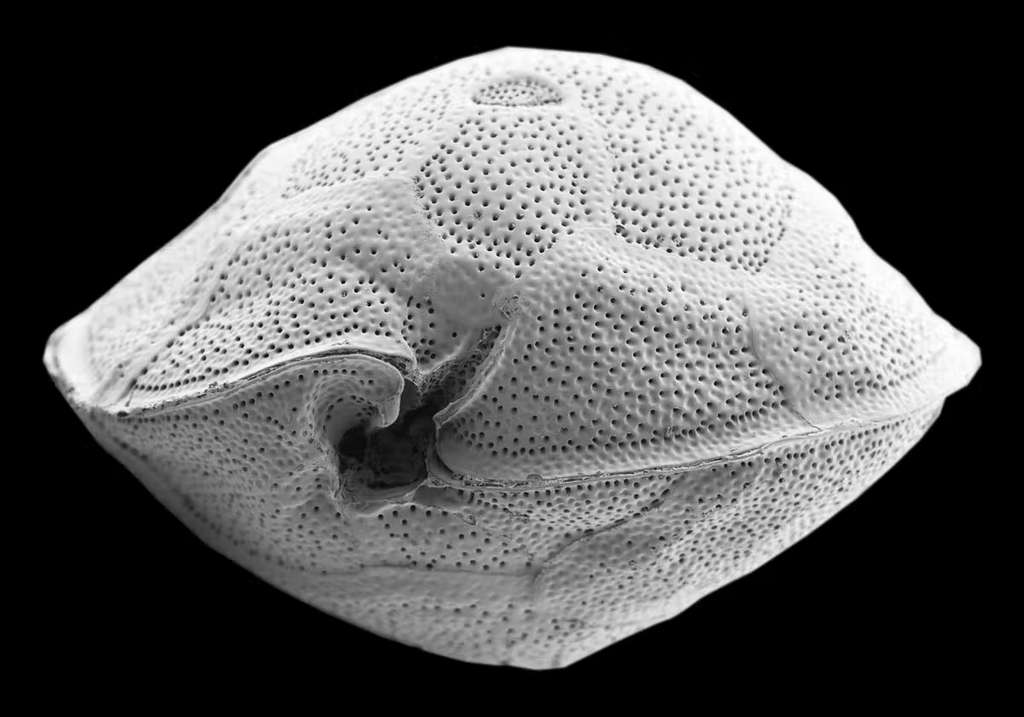 Cellule de Gambierdiscus (diamètre : 85 µm) observée au microscope électronique à balayage. © Nicolas Chomérat, Ifremer