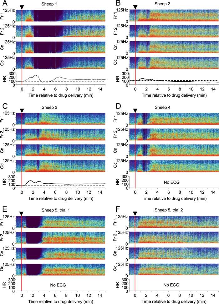 https://cdn.futura-sciences.com/buildsv6/images/mediumoriginal/d/6/5/d65621e5e2_50164780_010-ketamine-brain-activity-1.jpg