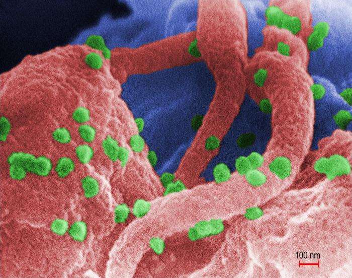 Le VIH, ici en vert, descend d'une souche de VIS. Tous deux infestent et tuent de préférence les lymphocytes T CD4+, acteurs indispensables de l'immunité. Sauf si l’on inocule à l'organisme le bon vaccin... © C. Goldsmith et al., CDC