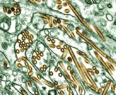 Le virus influenza A(H5N1) en culture sur des cellules MDCK (en vert). © CDC, K.Goldsmith, J. Katz and S. Zaki, reproduction et utilisation interdites