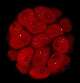 Les cellules cancéreuses (ici celles d'une tumeur mammaire) ont la particularité de se diviser sans arrêt. Le CPEB4 induirait un état cellulaire proche de celui qui existe durant le développement embryonnaire. © TheJCB, Flickr CC by nc sa 2.0