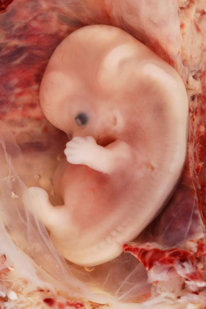 Embryon de neuf semaines issu d’une grossesse extra-utérine, ou GEU. Dans de nombreux cas, la GEU peut nécessiter une prise en charge hospitalière d’urgence. © Ed Uthman, Wikimedia Commons, cc by sa 2.0