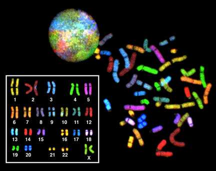 Caryotype d'un individu féminin : deux chromosomes X sont présents. Ce chromosome sexuel peut être à l'origine de nombreuses pathologies. © NIH, domaine public, Wikimedia Commons