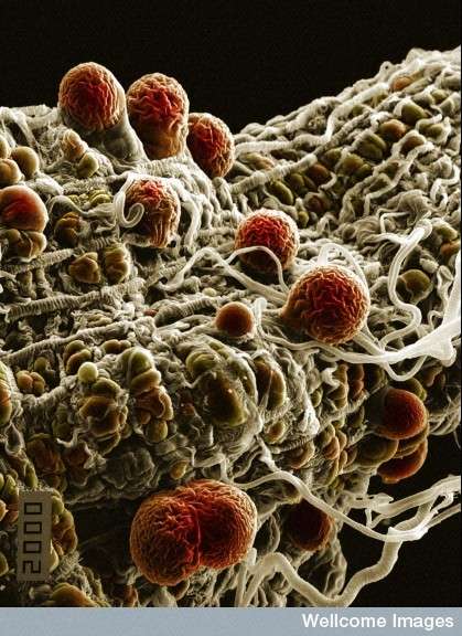 Le Plasmodium, le parasite qui cause le paludisme, passe du moustique à l'Homme au moment de la piqûre de l'insecte. Il cause des fièvres et des douleurs fortes, parfois mortelles. © Hilary Hurd, Wellcome Images, Flickr, cc by nc nd 2.0 