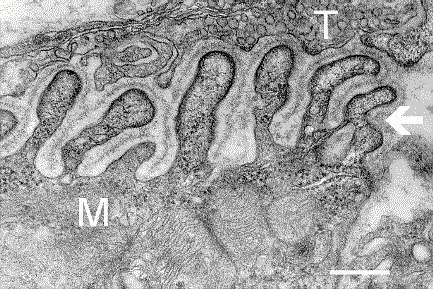 Jonction neuromusculaire observée au microscope électronique. Il s'agit de la zone de contact entre une fibre musculaire (M) et un neurone moteur, avec sa terminaison nerveuse (T). La barre représente 0,3 µm. © NIH, Wikimedia Commons, DP