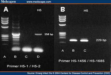 Diagnostic par technique de RT-PCR du virus H5. © Center for disease control and prevention, reproduction et utilisation interdites