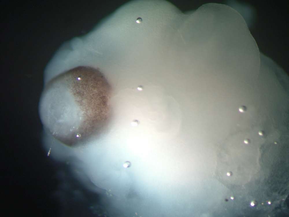 Cette image d'un organoïde cérébral laisse apparaître de l'épithélium rétinien (en marron) entouré de tissu cérébral. © Madeline Lancaster et al., Nature