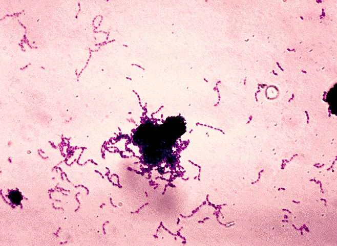 La bactérie Streptococcus mutans est l'une des principales responsables des caries dentaires, mais n'est pas la seule. L'alimentation, le stress et le système immunitaire sont autant de paramètres qui interviennent également. © CDC, Wikipédia, DP
