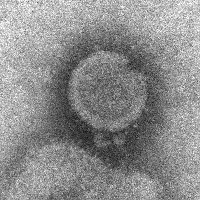 Une des premières images prises au microscope électronique à transmission du virus de la grippe A(H7N9). Il détient encore beaucoup de secrets. © C. Goldsmith, CDC, DP
