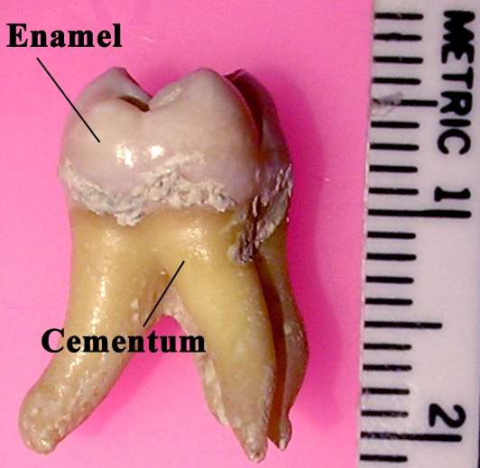L'émail (Enamel) des dents constitue l'un des tissus les plus externes et les plus solides. C'est celui qui a été étudié par les scientifiques. Le cément (Cementum) constitue la partie qui recouvre la dentine dans la gencive. © Dozenist, Wikipédia, cc by sa 3.0