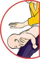 Cinq claques dans le dos du nourrisson positionné à plat ventre sur votre avant-bras. © Croix-Rouge française, G. Pascaud