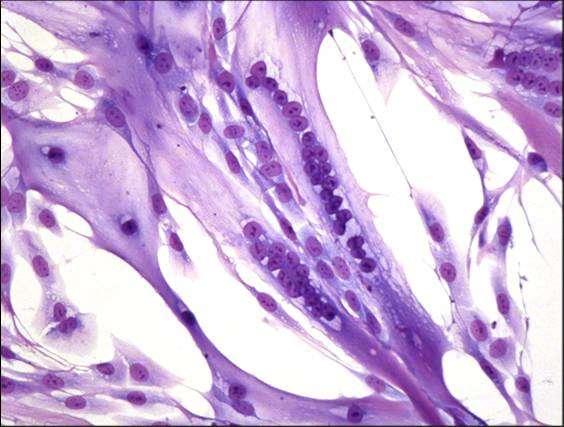À l'image, les cellules souches extraites 17 jours après la mort d'une dame. On peut les voir fusionner dans le tissu musculaire. © Fabrice Chrétien