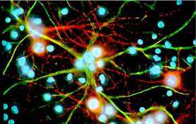 Culture mixte d'astrocytes (en vert) et de neurones (en rouge) issus de cortex de souris. En bleu, le noyau des cellules non marquées. © Karin Pierre, Institut de Physiologie, UNIL, Lausanne, DR