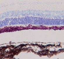 Les cellules souches injectées dans la rétine de rats forment une couche de cellules (violet) entre les photorécepteurs (bleu) et l'épithélium pigmentaire (noir). © Trevor McGill / StemCells